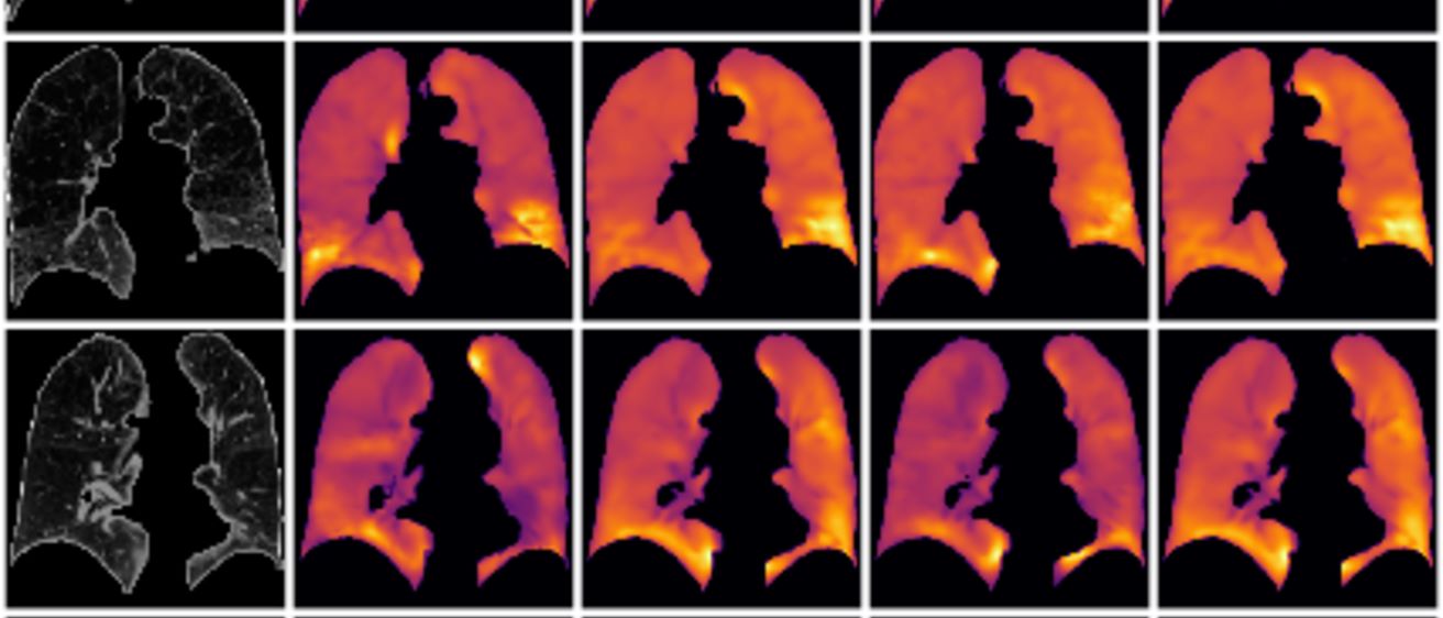 Images of lungs