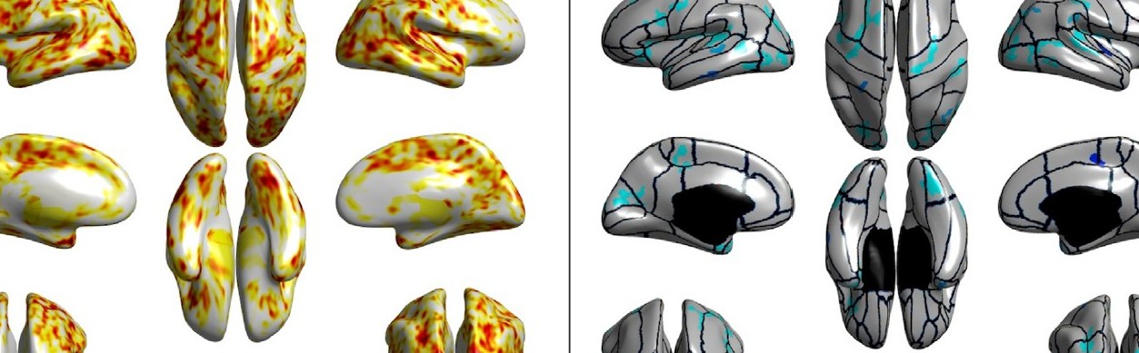 Hans Johnson Publication Brain Images