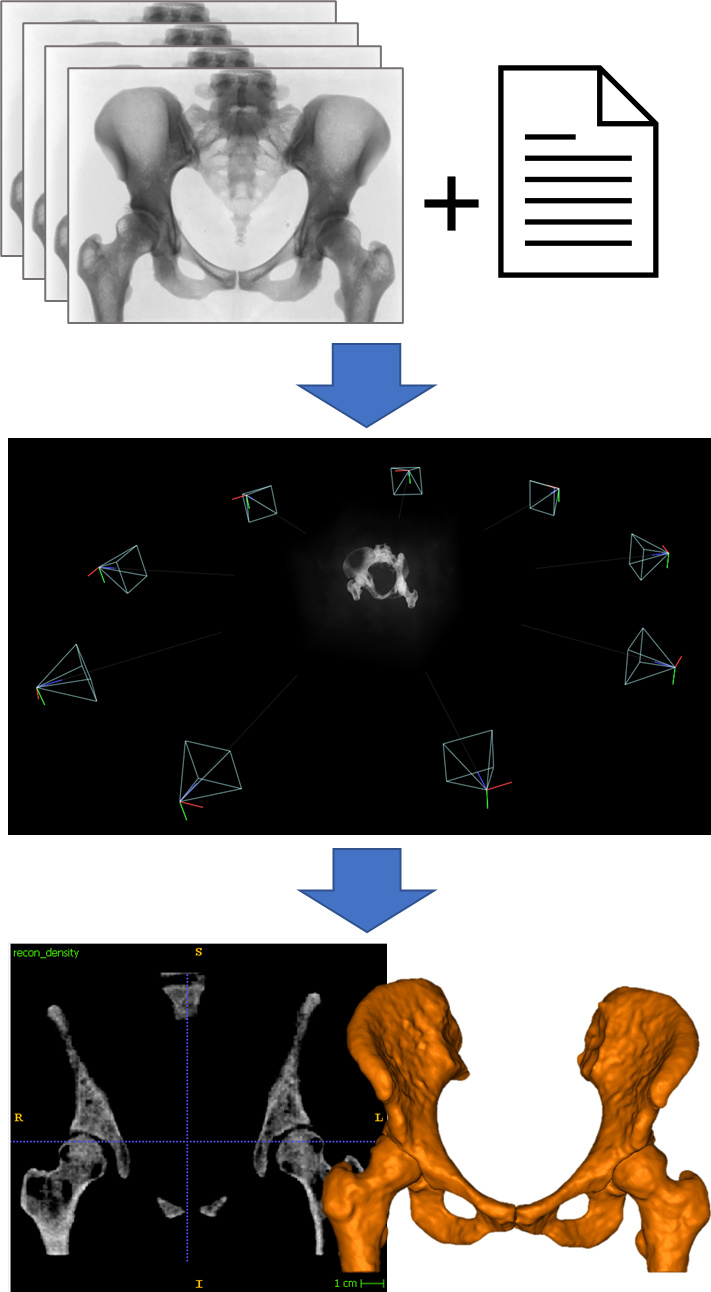 fluoroscopic to CT imaging