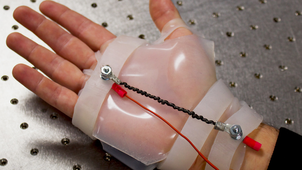 Robotic rehab device on a person's hand