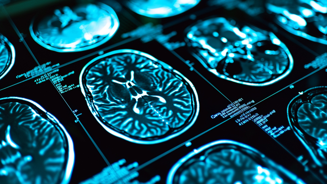 brain scan medical image